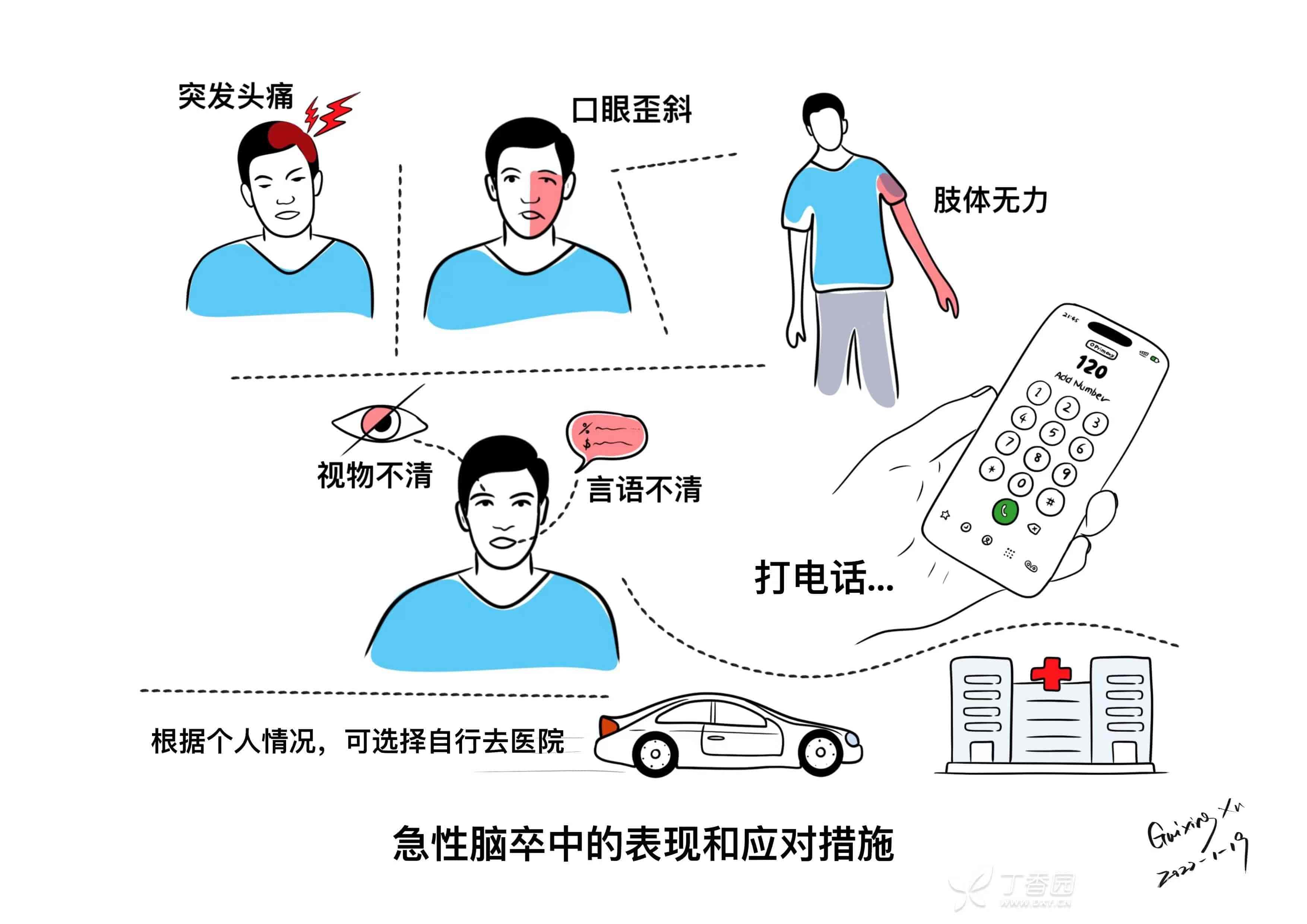急型脑卒中的的表现和应对措施