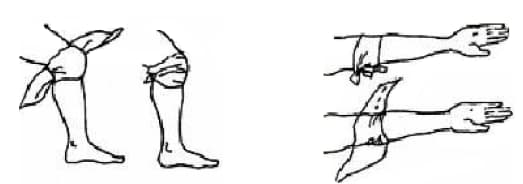 三角巾膝、肘包扎图