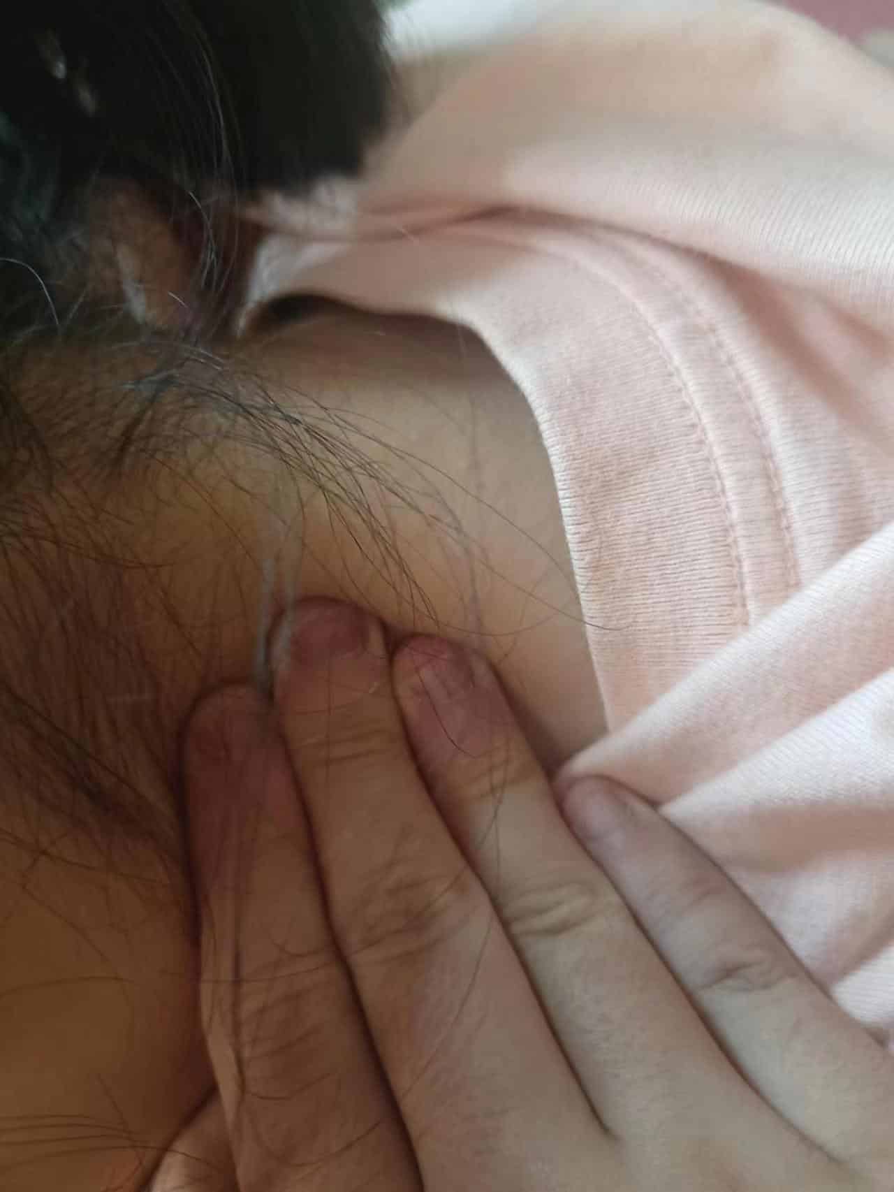 斜角肌按摩手法